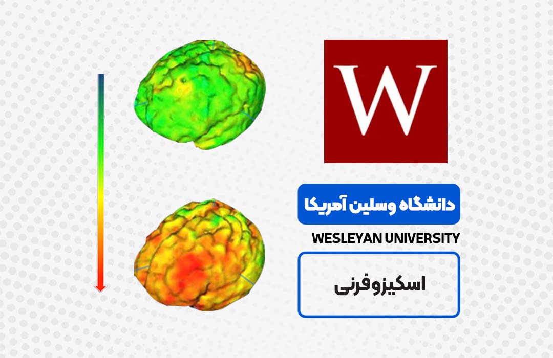 دوره اسکیزوفرنی در دانشگاه وسلین در مجموعه فرامدرک